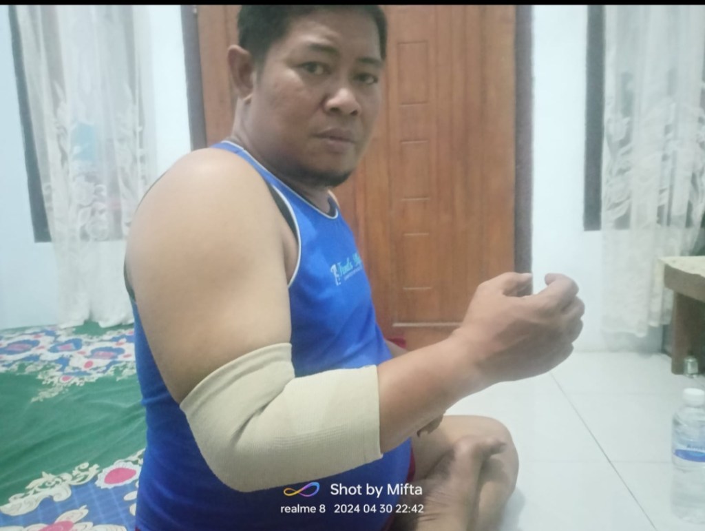 Terkesan Ngawur Proses Perbaikan Jalan Utama Surabaya-Malang, Jurnalis Pasuruan Terjatuh Akibat Cor Tengah&nbsp;Jalan