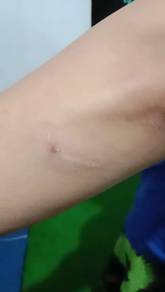 Istrinya di Aniaya, Warga Desa Jatiarjo Akan Laporkan Pelaku ke Polisi